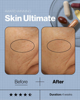 Advanced Nutrition Programme Skincare Ultimate (28 days supply of 5 capsules)