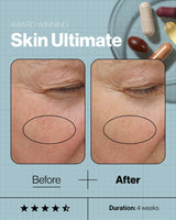 Advanced Nutrition Programme Skincare Ultimate (28 days supply of 5 capsules)