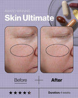 Advanced Nutrition Programme Skincare Ultimate (28 days supply of 5 capsules)
