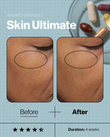 Advanced Nutrition Programme Skincare Ultimate (28 days supply of 5 capsules)