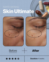 Advanced Nutrition Programme Skincare Ultimate (28 days supply of 5 capsules)