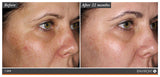 Environ Radiance+ Mela Even Cream (C Boost) 25ml