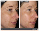 Environ Radiance+ Mela Even Cream (C Boost) 25ml