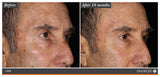 Environ Radiance+ Mela Even Cream (C Boost) 25ml