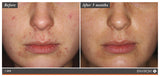 Environ Clarity+ Sebu Spot Blemish Gel 10ml